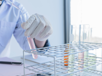 Badania laboratoryjne w kierunku diagnostyki raka jelita grubego